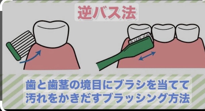 逆バス法