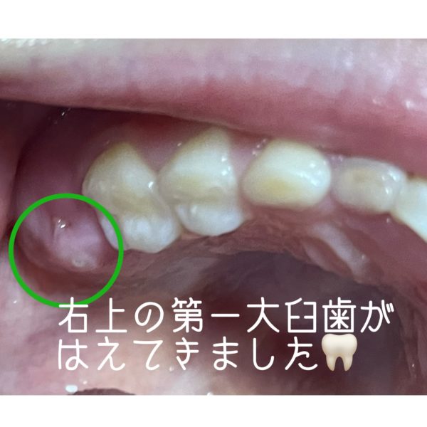歯の生え変わり